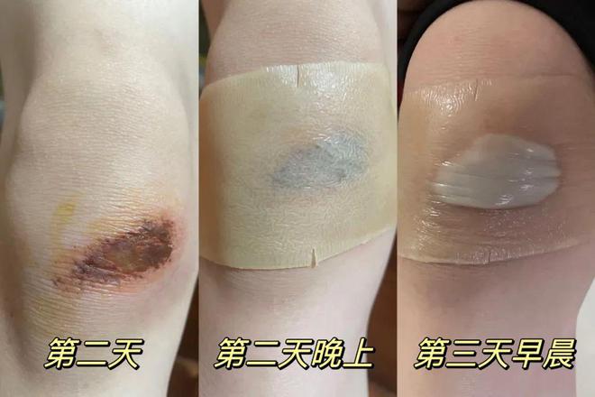 清单日常家庭药箱怎么写_日常家庭药箱清单_清单日常家庭药箱怎么做