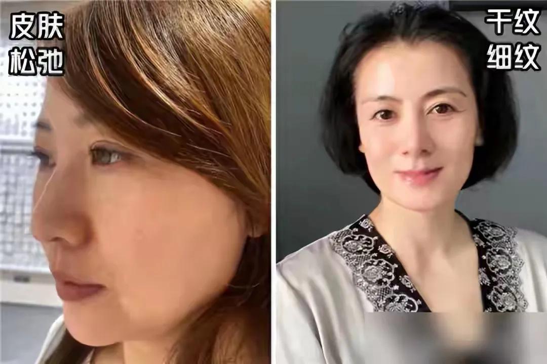 器材肌肉锻炼健身用什么_不用健身器材锻炼肌肉_器材肌肉锻炼健身用什么好